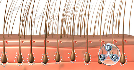 Die Hormone der Haarausfall die fettige Haut